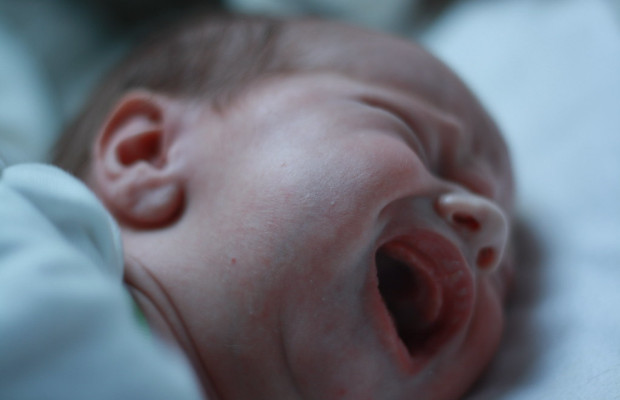 SINDROME BIMBO SCOSSO, <BR> FATALE IN 1 CASO SU 4 