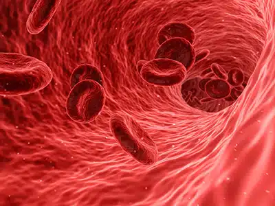 ANEMIA EMOLITICA: UNO STUDIO ITALIANO CI DICE COME TRATTARLA 