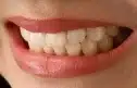 Nel 1822 i primi denti artificiali âmoderniâ