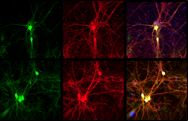 NEURODEGENERAZIONE <BR> UN NUOVO APPROCCIO