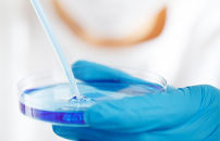 Ricerca, leucemia linfatica cronica: terapie avanzate personalizzate per pazienti over 80