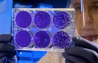 Acqua termale euganea alleata contro il Covid: studio dellâateneo di Padova pubblicato su Biomedicines