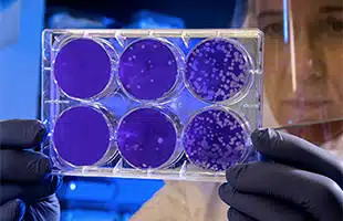 Cellule staminali personalizzate per curare le malattie neurodegenerative
